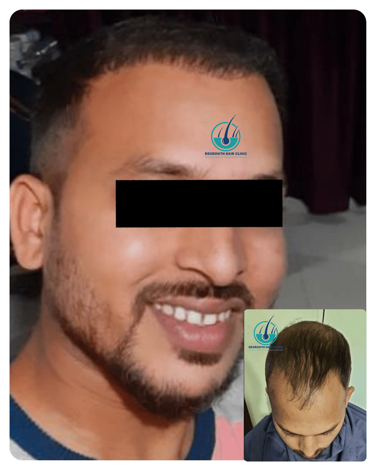 Regrowth Hair Clinic Raipur CG 9