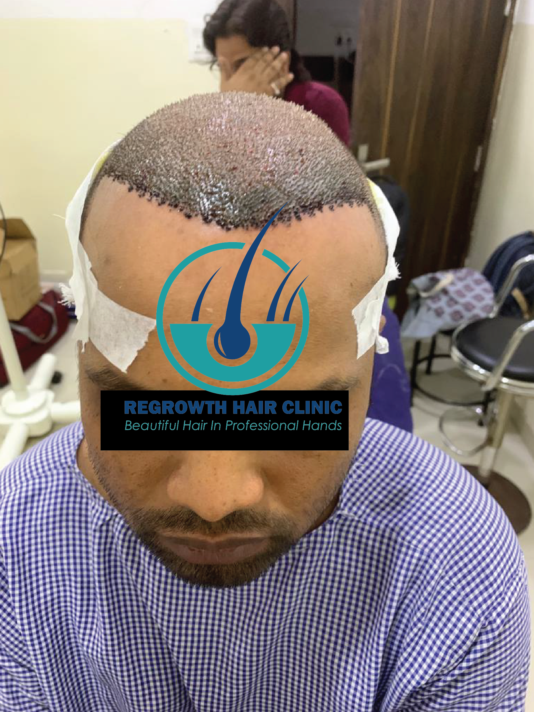 Regrowth Hair Clinic In Raipur 23-01